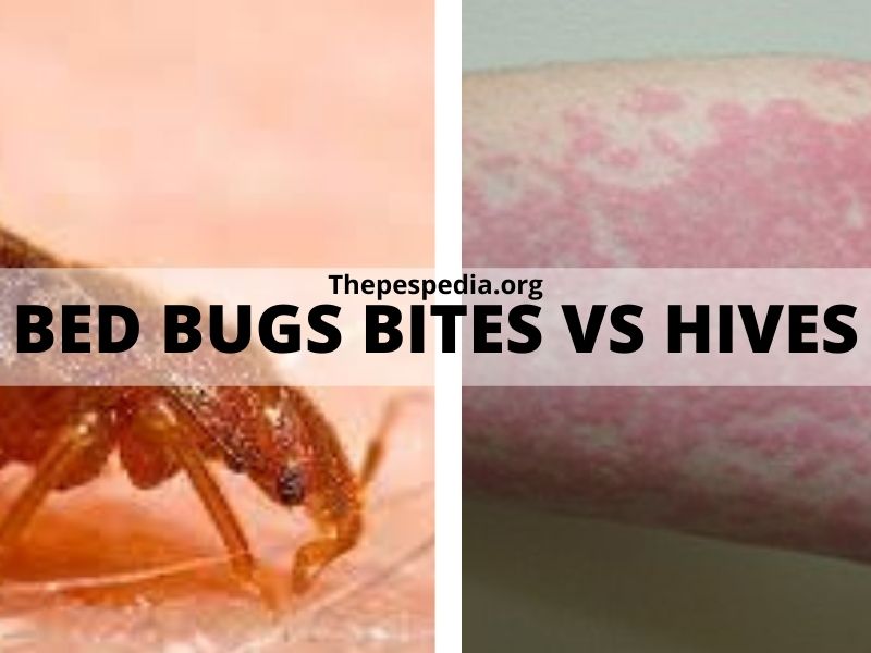 Bed Bugs Bites Vs Hives