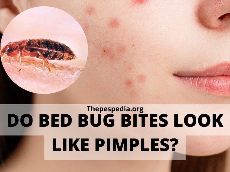 Do Bed Bug Bites Look Like Pimples