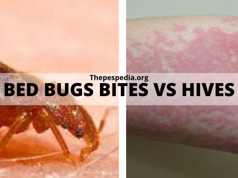 Bed Bugs Bites Vs Hives: What Is The Difference {IN TABLE}